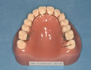 リンガルアーチ